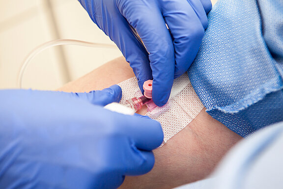 Hände mit blauen Latexhandschuhen legen einen Zugang am Arm für die Infusionstherapie