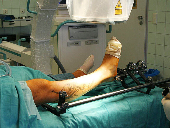 Behandlungsschwerpunkt Knochenbruchbehandlung