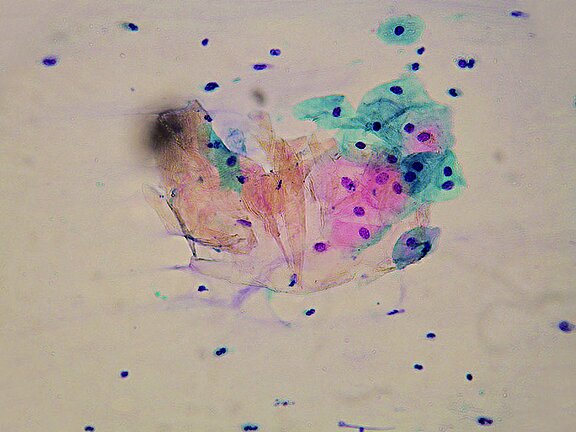 Dysplasiesprechstunde