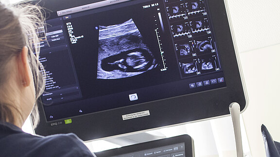 Ultraschalluntersuchung einer Schwangeren