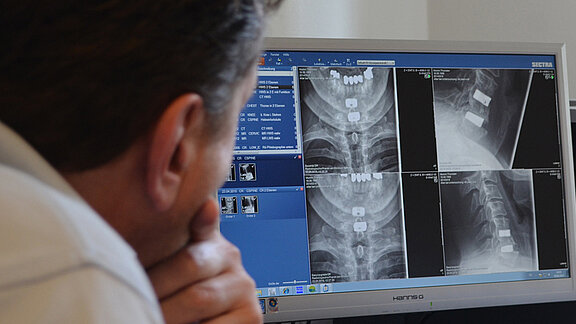 Begutachtung von Röntgenbilder am Bildschirm.