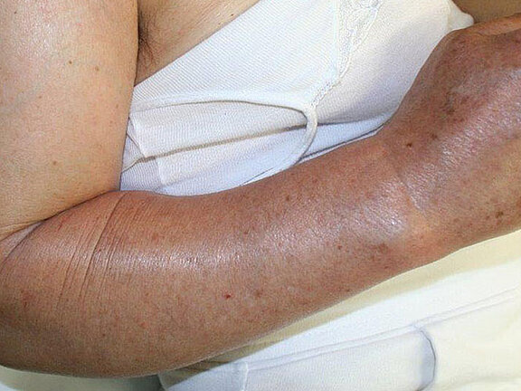 Behandlungsschwerpunkt Infektbehandlung