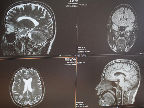 Röntgenbild vom Kopf (Ansichten von oben und von der Seite)